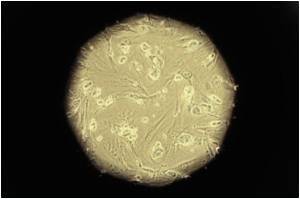  Stem Cell Therapy for Eyes